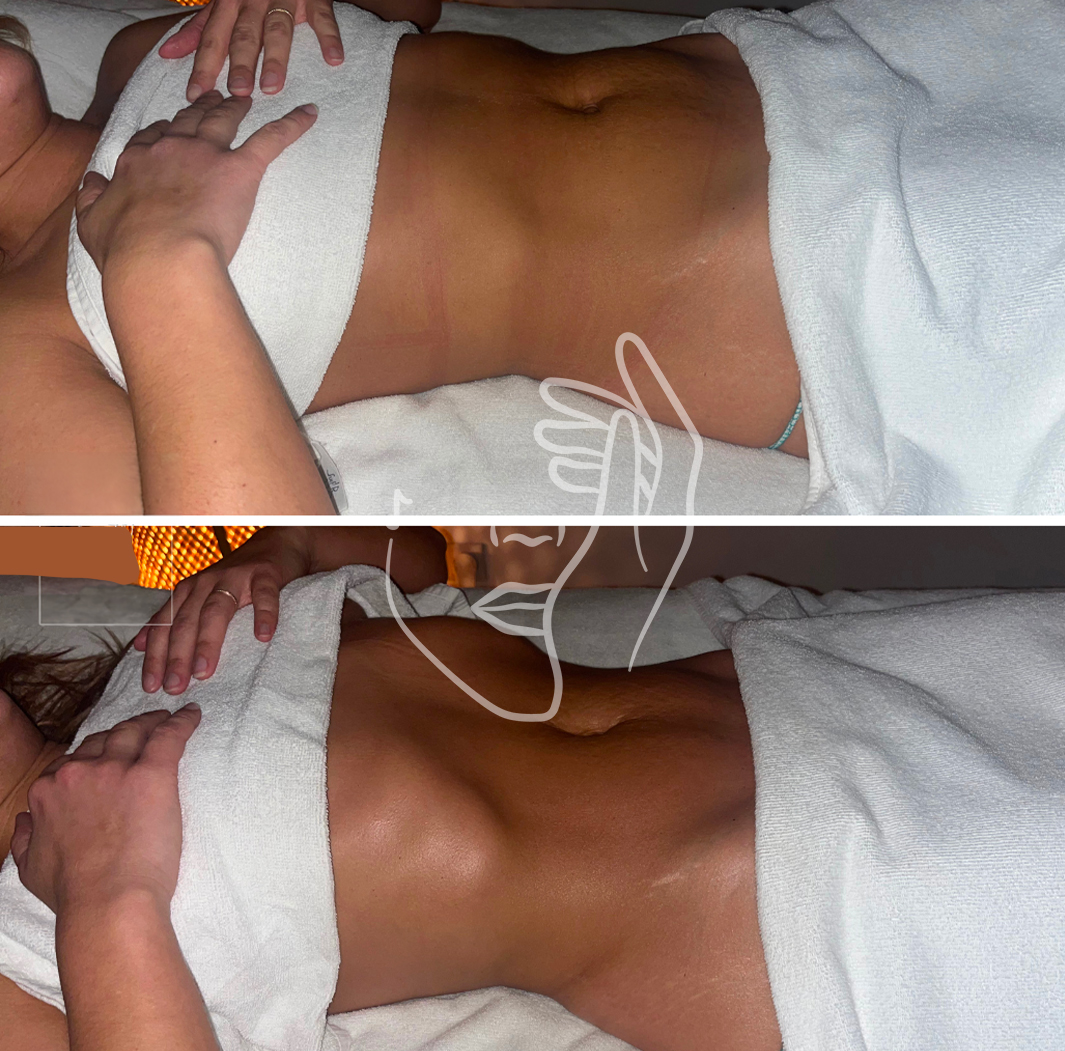 Lympho Sculpt® ANA GIA