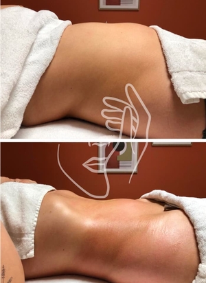 Drainage Lymphatique et remodelage · 5 séances