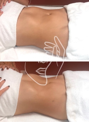 Drainage Lymphatique et remodelage · 5 séances