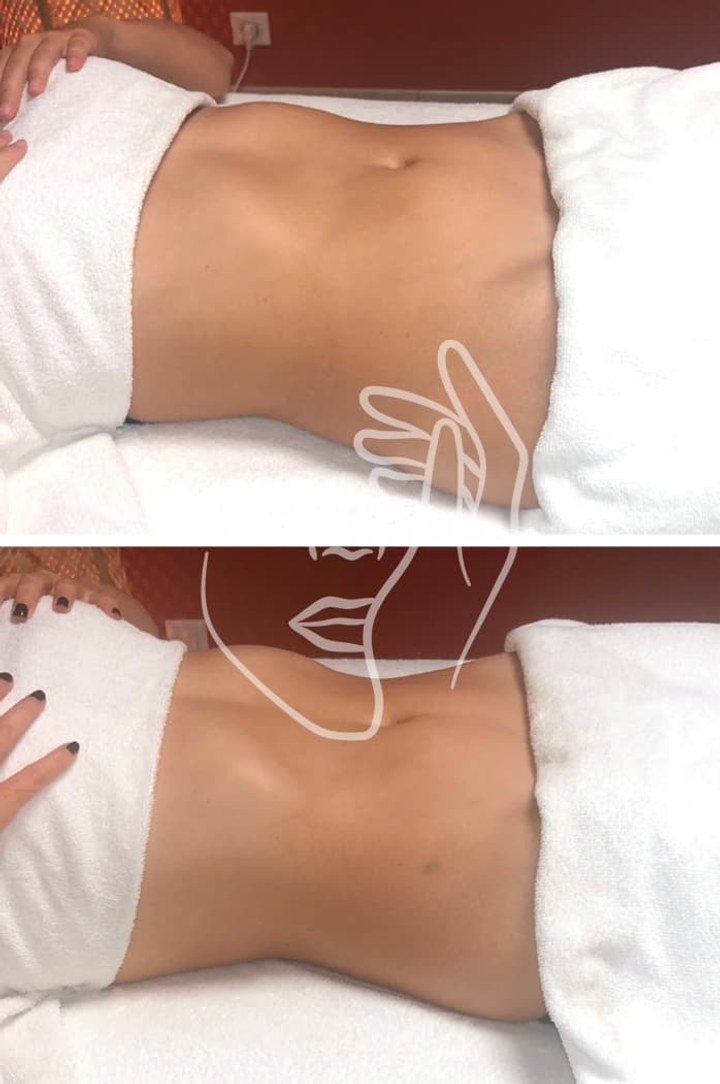 Lympho Sculpt® ANA GIA