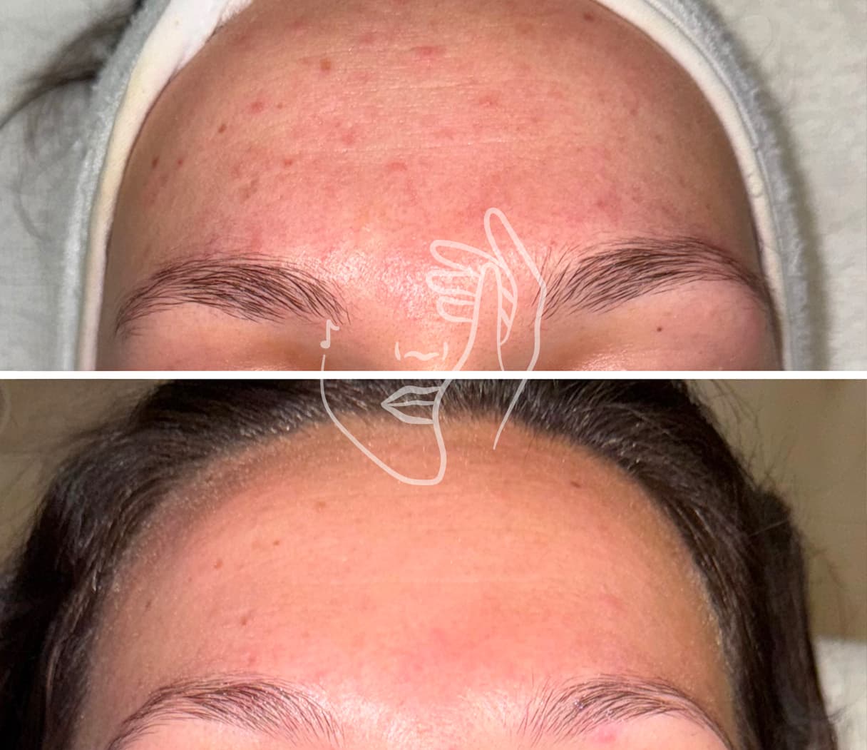 Lympho Sculpt® ANA GIA