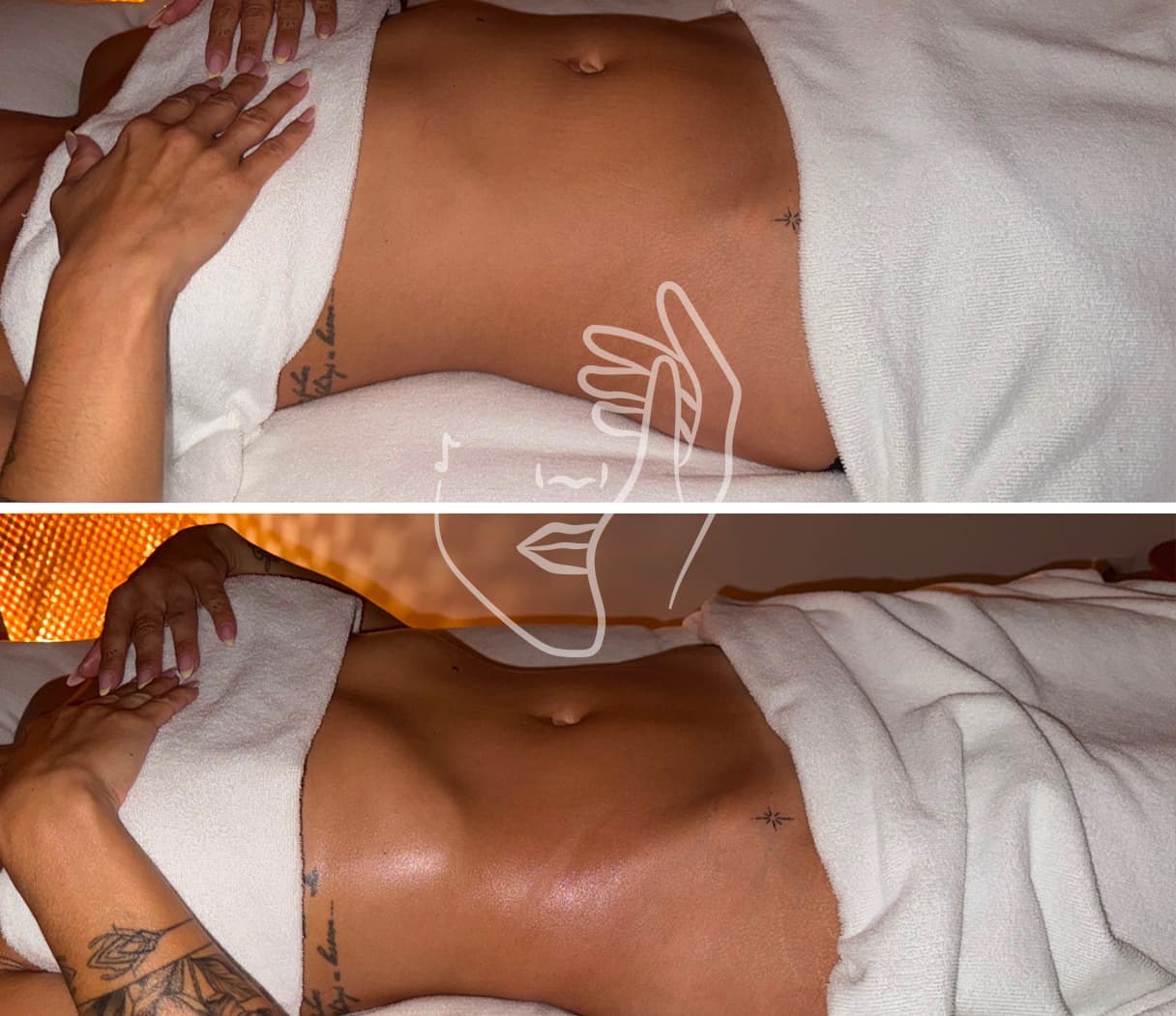 Lympho Sculpt® ANA GIA